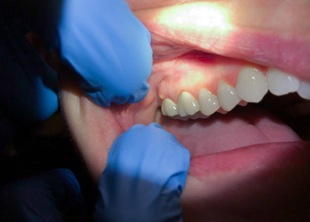 Best Emergency Broken Tooth Repair in Chouteau, OK