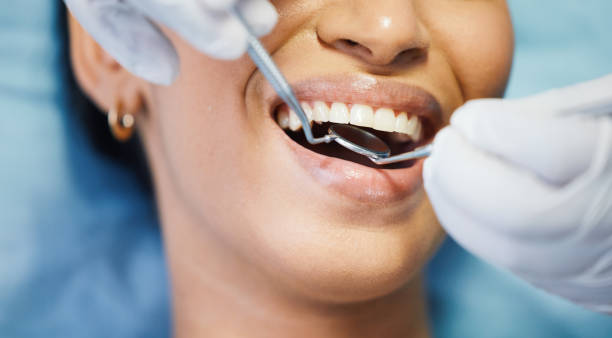 Best Walk-In Emergency Dentist in Chouteau, OK