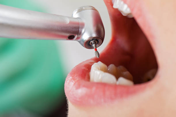 Best 24-Hour Emergency Dentist in Chouteau, OK